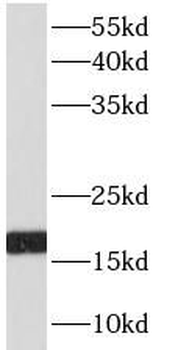 CFL1 Rabbit Polyclonal Antibody