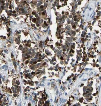 CFL1 Rabbit Polyclonal Antibody