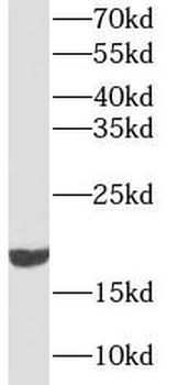 CFL1 Mouse Monoclonal Antibody