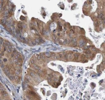 CFL1 Mouse Monoclonal Antibody