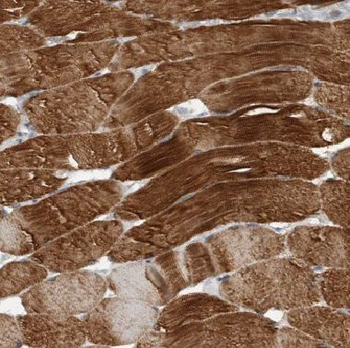 CFL2 Rabbit Polyclonal Antibody