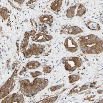 COG3 Rabbit Polyclonal Antibody
