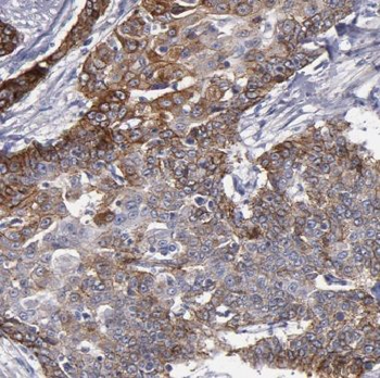 COG7 Rabbit Polyclonal Antibody