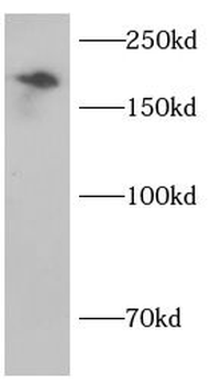 Collagen Type IV Rabbit Polyclonal Antibody