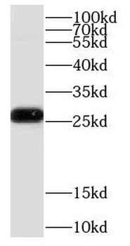 COMMD5 Rabbit Polyclonal Antibody