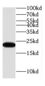 COMMD8 Antibody
