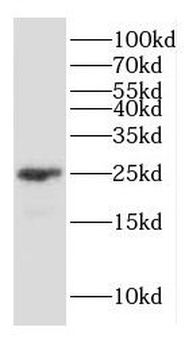 GJB2 Antibody