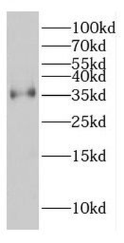 COPE Rabbit Polyclonal Antibody