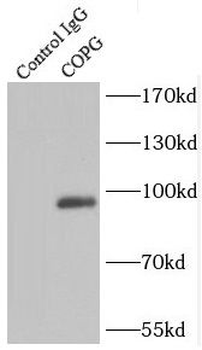 COPG1 Rabbit Polyclonal Antibody