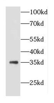 COQ5 Rabbit Polyclonal Antibody