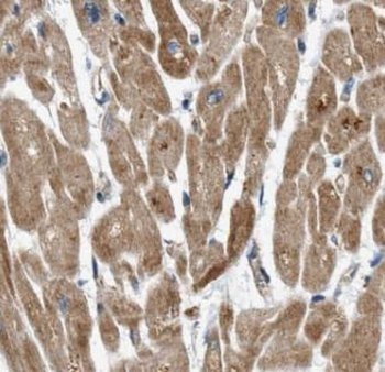COQ6 Rabbit Polyclonal Antibody