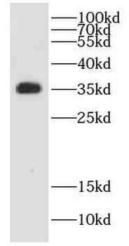 COQ9 Rabbit Polyclonal Antibody