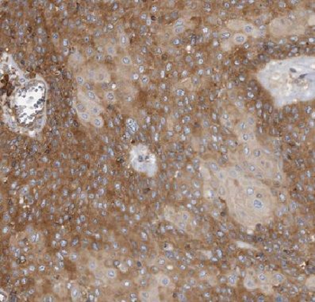 COQ9 Rabbit Polyclonal Antibody