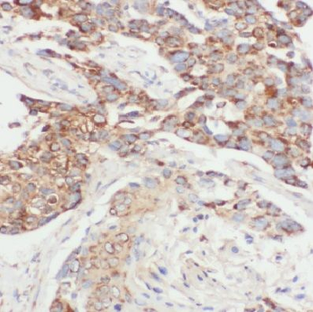 COTL1 Mouse Monoclonal Antibody