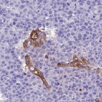 CPB1 Rabbit Polyclonal Antibody