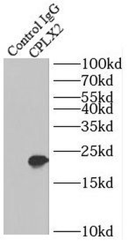 CPLX2 Antibody