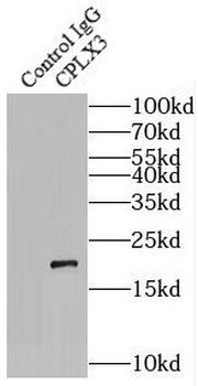 CPLX3 Antibody