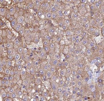 CPN1 Rabbit Polyclonal Antibody
