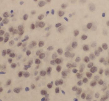 CPSF2 Rabbit Polyclonal Antibody