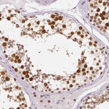 CPSF7 Rabbit Polyclonal Antibody