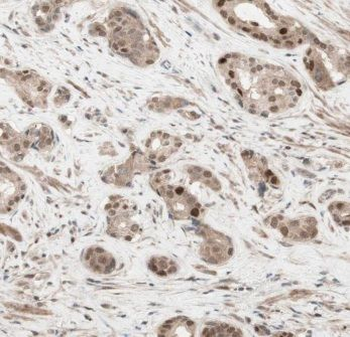 CREB3 Rabbit Polyclonal Antibody