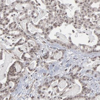 LUC7L3 Rabbit Polyclonal Antibody