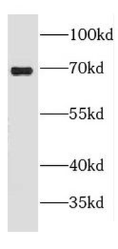CROT Antibody