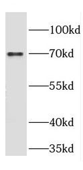 CRTAC1 Antibody