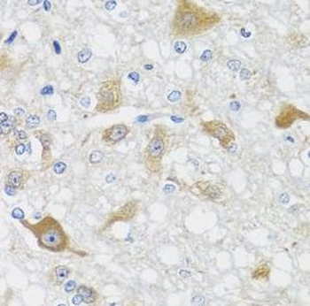 CRTAP Rabbit Polyclonal Antibody