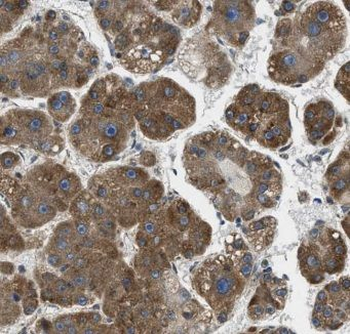 CSAD Antibody