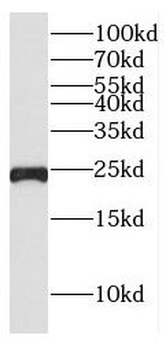 CSHL1 Rabbit Polyclonal Antibody