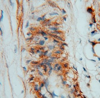 CSHL1 Rabbit Polyclonal Antibody