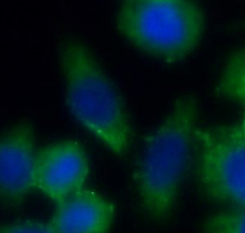 CSNK2A1 Antibody