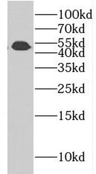 CSTF1 Rabbit Polyclonal Antibody