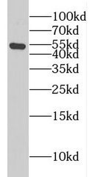 CSTF1 Rabbit Polyclonal Antibody