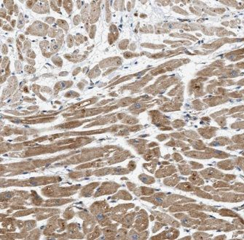CCN2 Rabbit Polyclonal Antibody