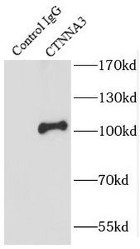 CTNNA3 Rabbit Polyclonal Antibody