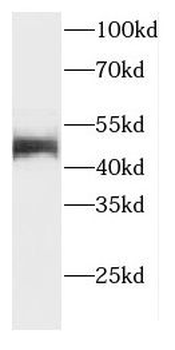 CTNS Rabbit Polyclonal Antibody