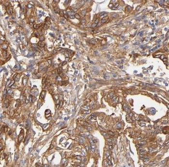 CTNS Rabbit Polyclonal Antibody