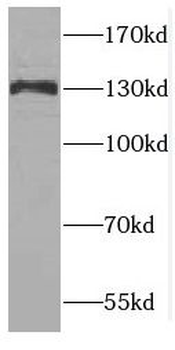 CTR9 Antibody