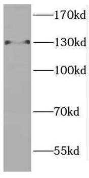 CTR9 Antibody