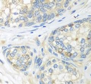 CUL3 Rabbit Polyclonal Antibody
