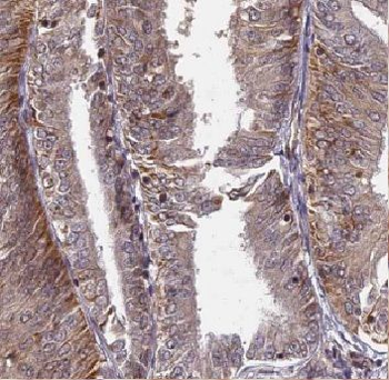 CUTC Rabbit Polyclonal Antibody