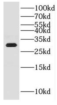 CWC15 Rabbit Polyclonal Antibody