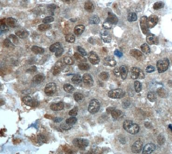 CWC15 Rabbit Polyclonal Antibody