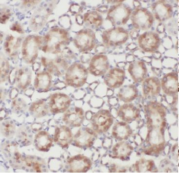CWF19L2 Rabbit Polyclonal Antibody