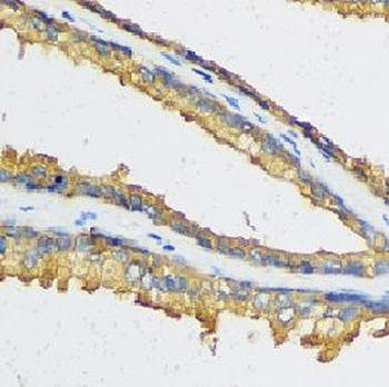 CXCL11 Antibody