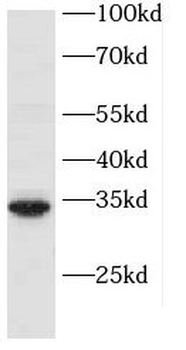 PBDC1 Antibody