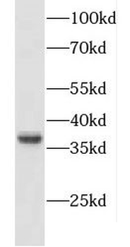 CXXC5 Antibody