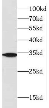CYB5R1 Antibody